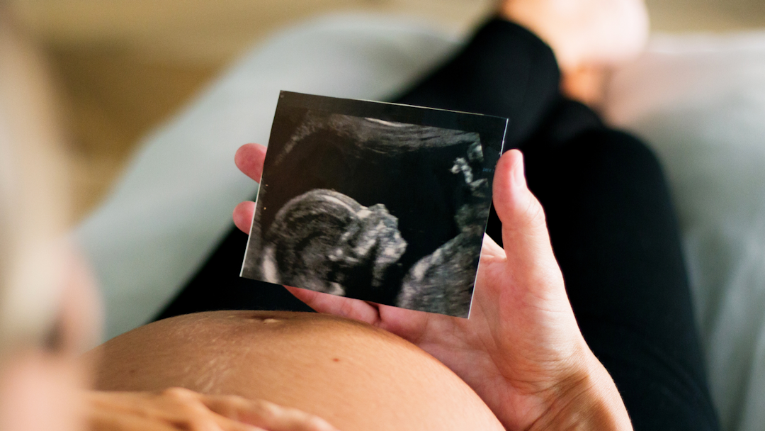 Fetal Medicine Wonders: Nurturing Health and Happiness in the Womb