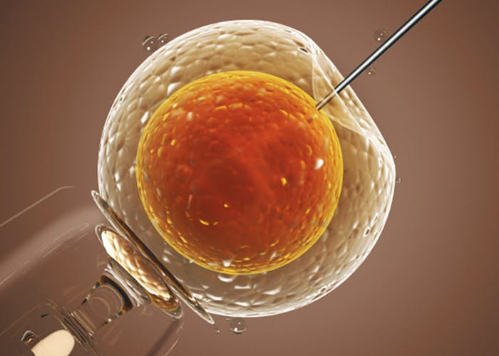 Advanced semen testing for infertility