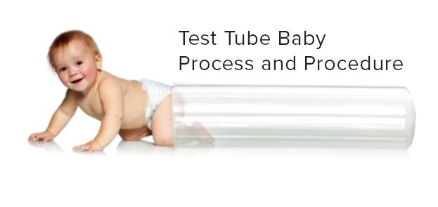 Test Tube Baby Process and Procedure